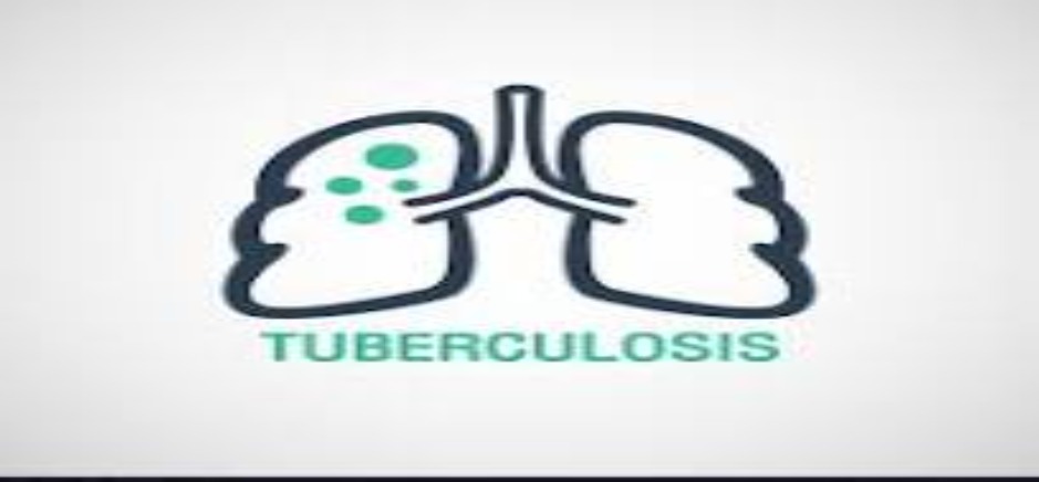 Expert warns against Stigmatization of T.B Survivors  